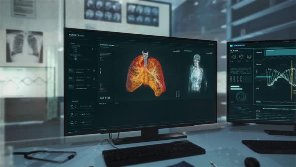 Advanced Medical Software Analyzing Patient's Data To Diagnose Covid-19 alt