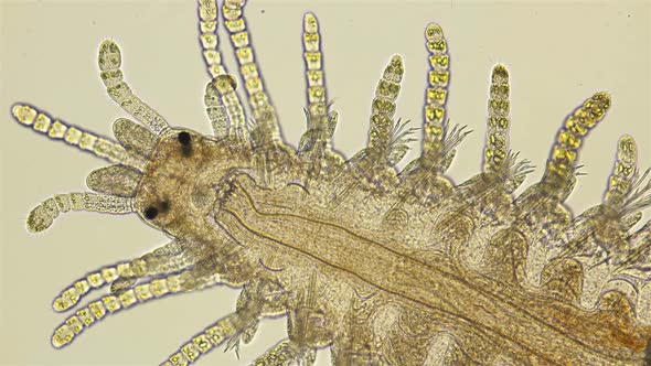 a Sea Ciliary Worm of the Syllidae Family Under a Microscope, Differs in Others By the Presence  alt