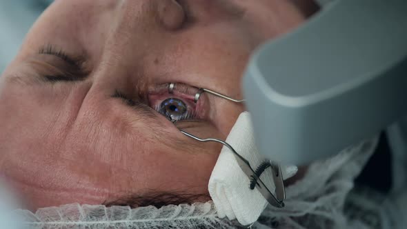 A Patient is Having Laser Correction of Eyesight