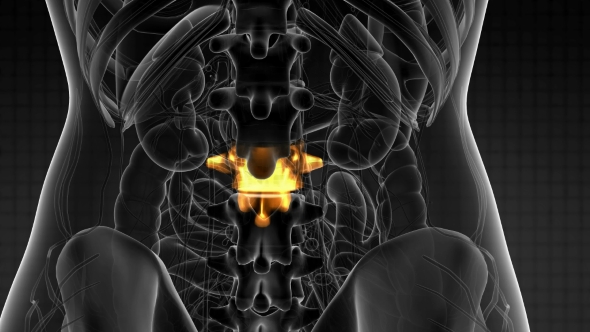 Backache in Back Bones alt