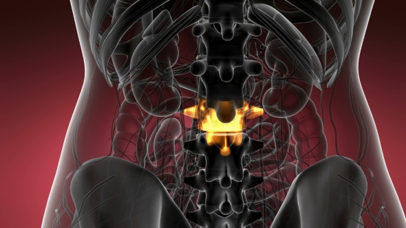 Backache in Back Bones alt