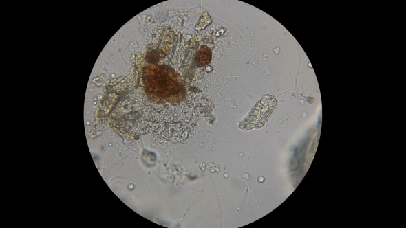 Microorganisms,the Inhabitants of the Aquarium Under the Microscope