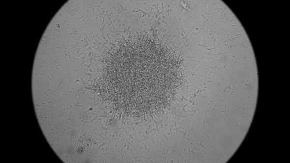 Colony of Bacteria-cadaveric Fingers Under the Microscope