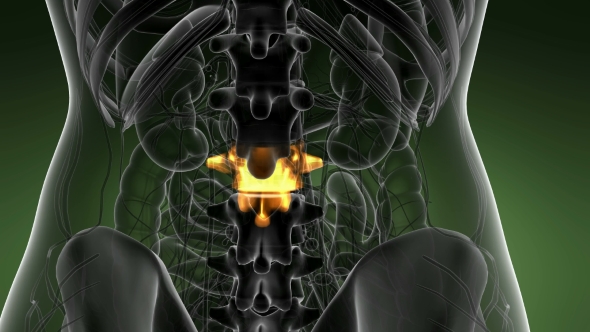 Backache in Back Bones alt