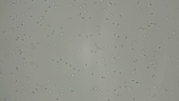 the Movement of the Sperm Under a Microscope alt