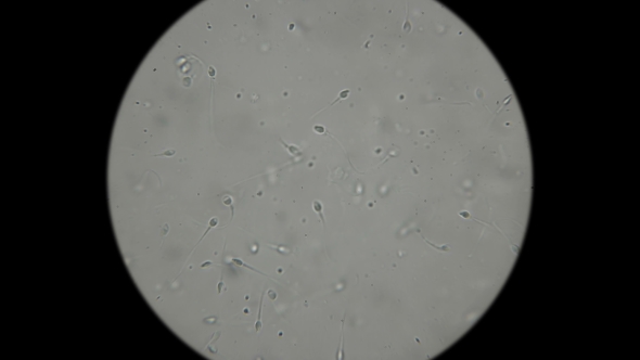 the Movement of the Sperm Under a Microscope alt