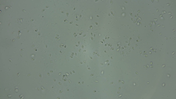 a Large Colony of Protozoa Moves Under a Microscope