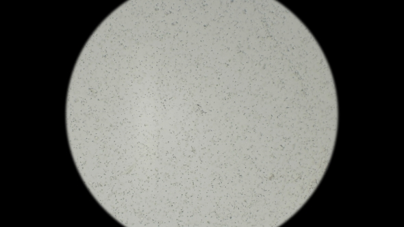 Movement of the Sperm Under a Microscope alt