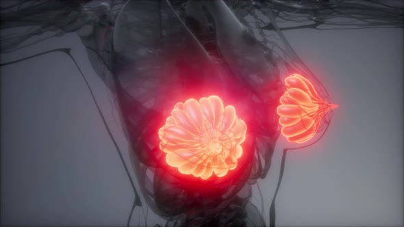 Medically Accurate Illustration of an Obese Womens Mammary Glands alt