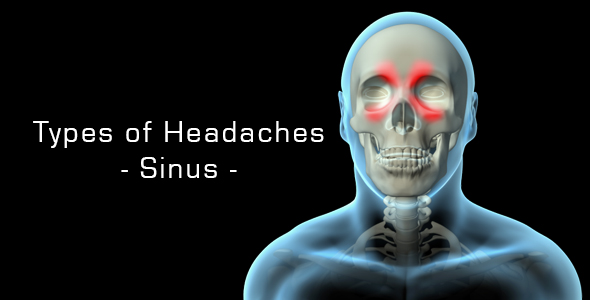 Types Of Headaches - Sinus