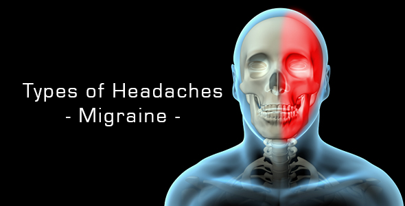 Types Of Headaches - Migraine