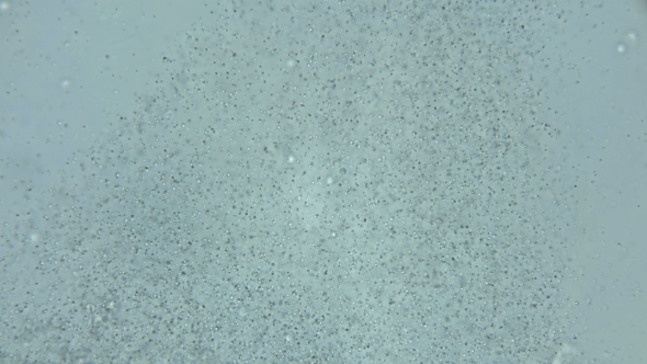 a Large Colony of Protozoa Moves Under a Microscope