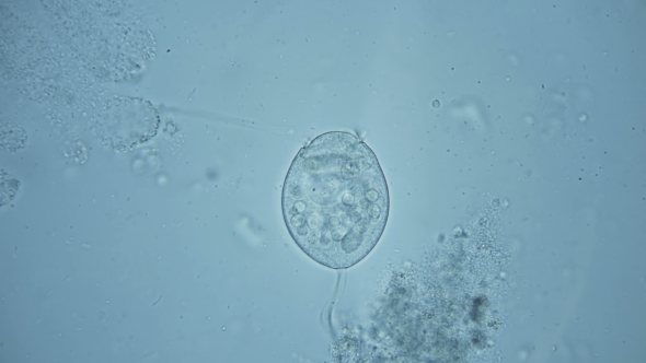Microorganisms - Inhabitants of the Aquarium Under the Microscope