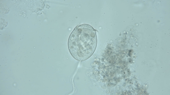 Microorganisms,the Inhabitants of the Aquarium Under the Microscope,like an Alien Organism