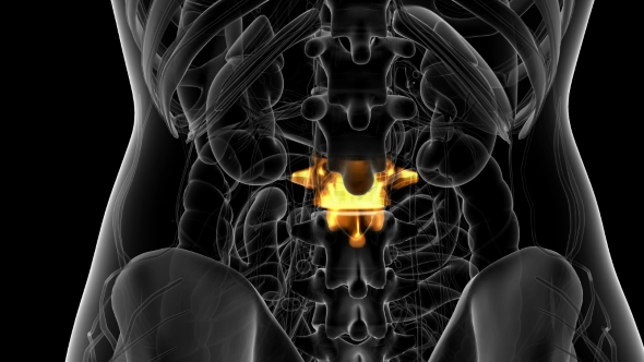 Backache in Back Bones alt