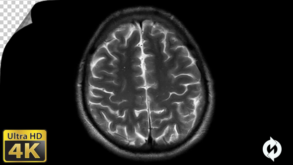 Human Brain MRI Scan - Alpha Channel alt