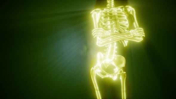 Human Bones Radiographic Scan alt