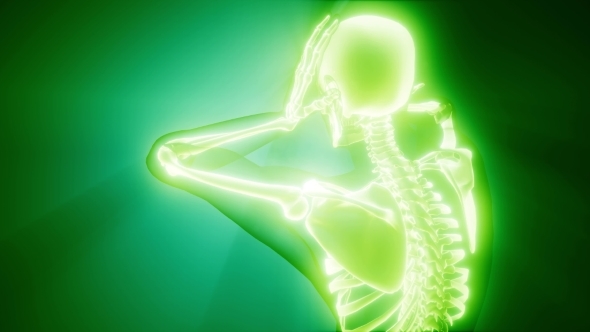 Human Bones Radiographic Scan alt