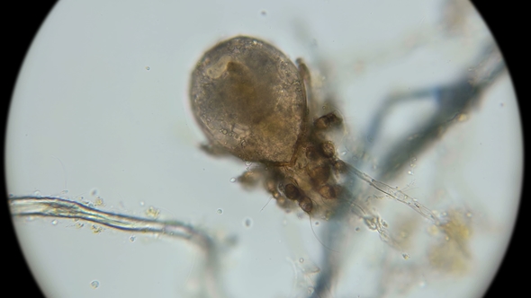 Dead Dust Mite Became the Habitat of Microorganisms, Under a Microscope