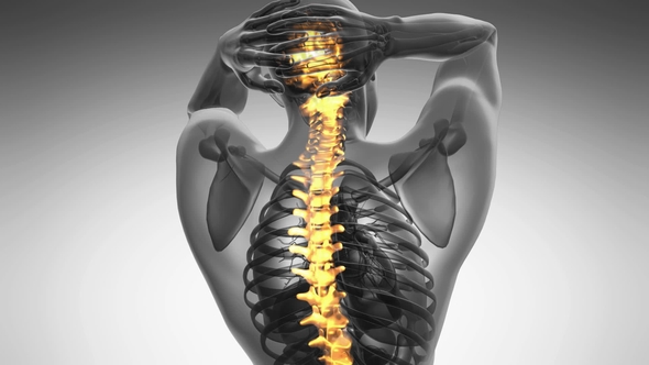 Backache in Back Bones alt