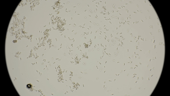 Large Colony of Protozoa Moves Under a Microscope