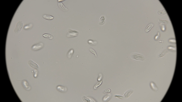 Large Colony of Protozoa Moves Under a Microscope