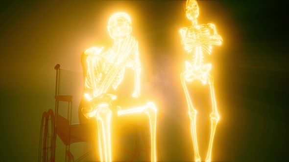 Man in Wheelchair with Visible Bones alt