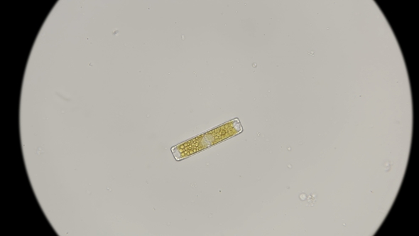 Diatom Algae in Fresh Water, Under a Microscope