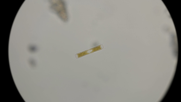 Diatom Algae in Fresh Water, Under a Microscope