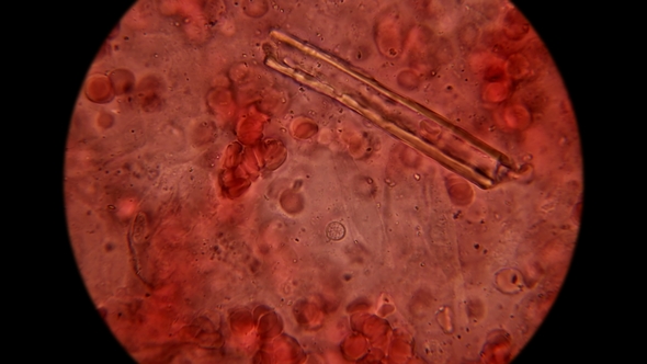 Menstrual Blood with Its Microflora and Bacteria Under Microscope