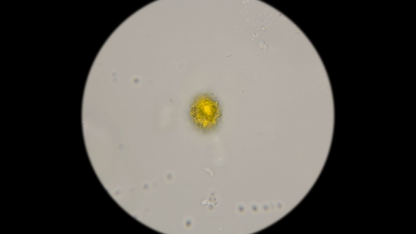 Rotavirus Infection in Human Saliva Under a Microscope