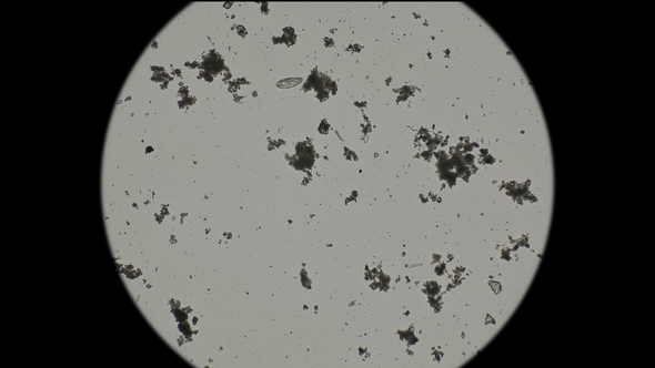 Microorganisms, Inhabitants of Reservoirs Under a Microscope, As an Alien Organism