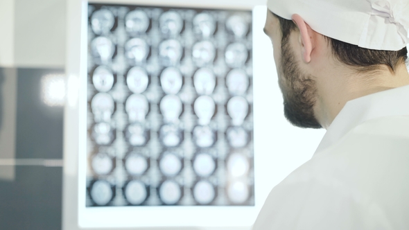 Doctor Observing Brain MRI Diagnostic in Hospital