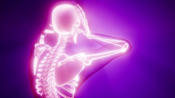 Human Bones Radiographic Scan alt