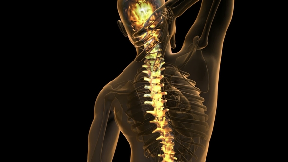 Backache in Back Bones alt