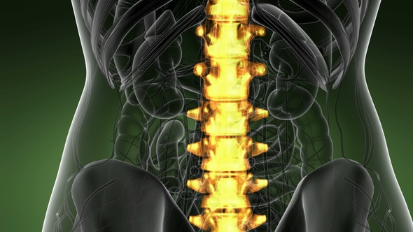 Backache in Back Bones alt