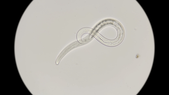 Nematode Worm Under a Microscope