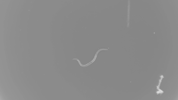 Nematode Worm Under a Microscope