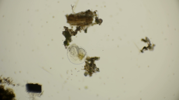 Rotua Synchaeta Pectinata Under the Microscope