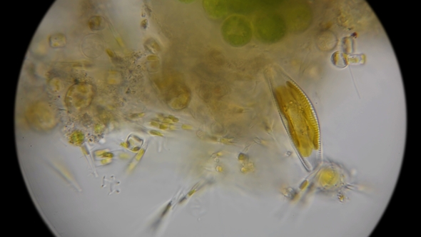 Diatoms and Microorganisms Under a Microscope