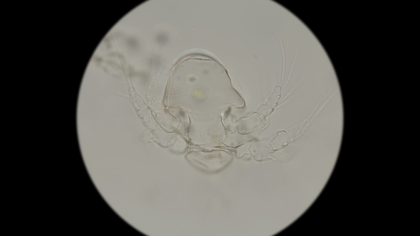 Discarded Shell of the Cyclops Nauplius Under the Microscope