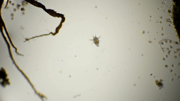 The Cyclops Nauplius Together with the Variety of Microorganisms of the Pond Under the Microscope