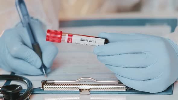 The Doctor Holds Hand Laboratory Positive Blood Test Tube for Virus Ebola