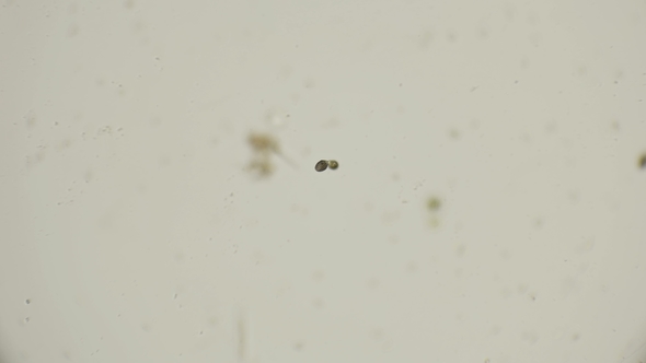 Infusoria Coleps Hirtus at the Stage of Division and Conjugation Under a Microscope alt