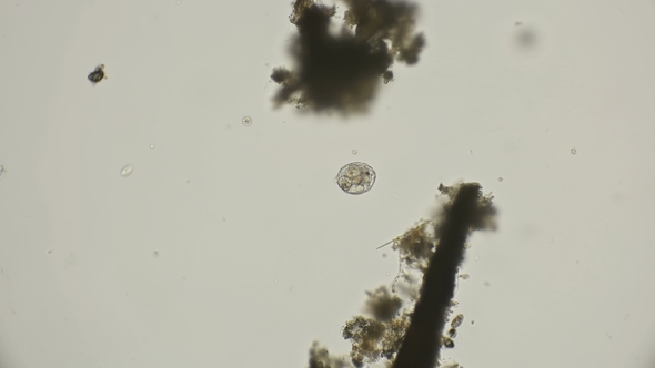 Rotifuge Cathypna Luna Under a Microscope