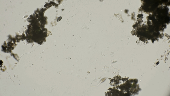 Infusoria Lacrimaria To Hunt and Quickly Moves Under a Microscope alt