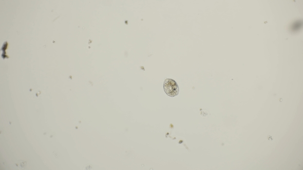 Rotifuge Cathypna Luna Under a Microscope