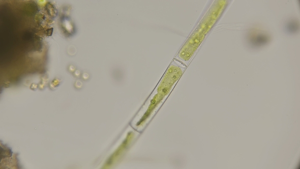 Filamentous Algae Under a Microscope