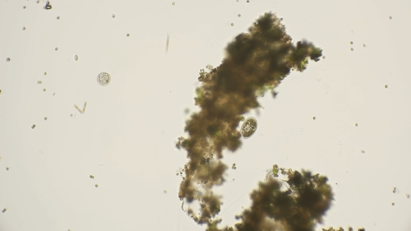 Ciliated Infusorians Under a Microscope