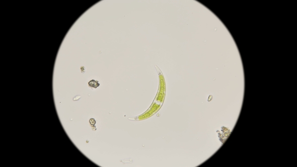 Diatoms Klosterium Under the Microscope